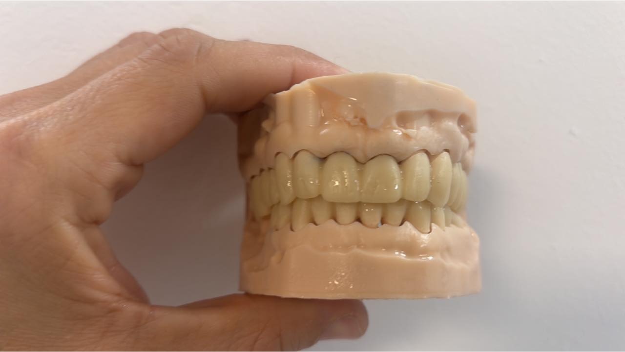 Prótesis dental sobre modelo realizada por Digital Lab Churriana